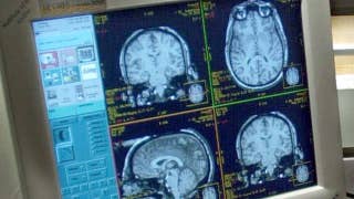 Lawsuit: Clinic falsely diagnosed patients with Alzheimer's - Fox News