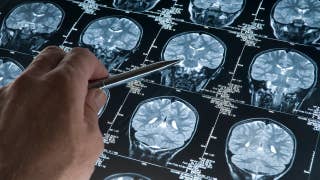 Scientists can now predict age Alzheimer’s disease sets in - Fox News