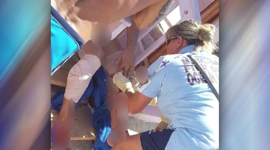 Man attacked as swimmers flee shark in South Florida