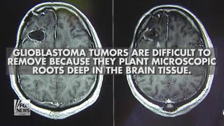 John McCain’s diagnosis: What is glioblastoma? - Fox News