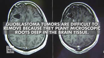 McCain brain tumor: What is glioblastoma?