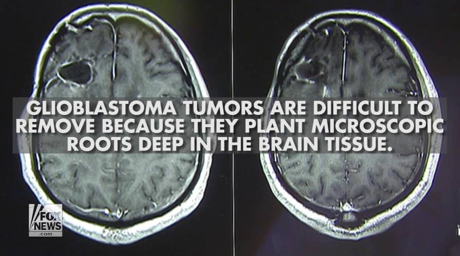 John McCain’s diagnosis: What is glioblastoma?