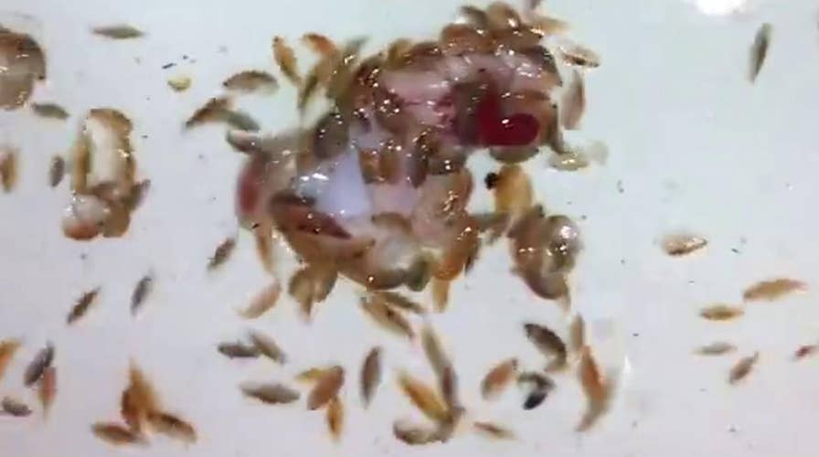 'Sea critters' that bloodied teen's feet, legs feast on meat