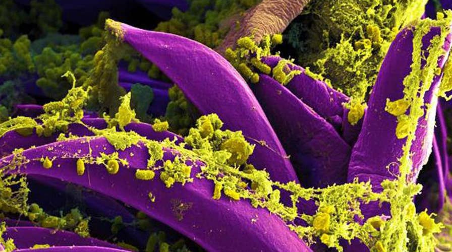 Ticks test positive for bubonic plague in Arizona