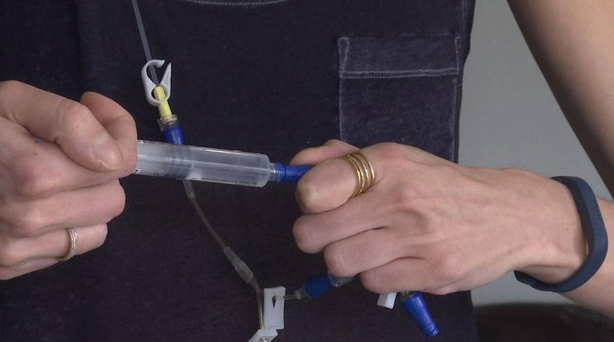 Double-lung transplant patient launches challenge