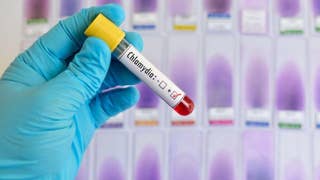 STD cases hit record high in US - Fox News