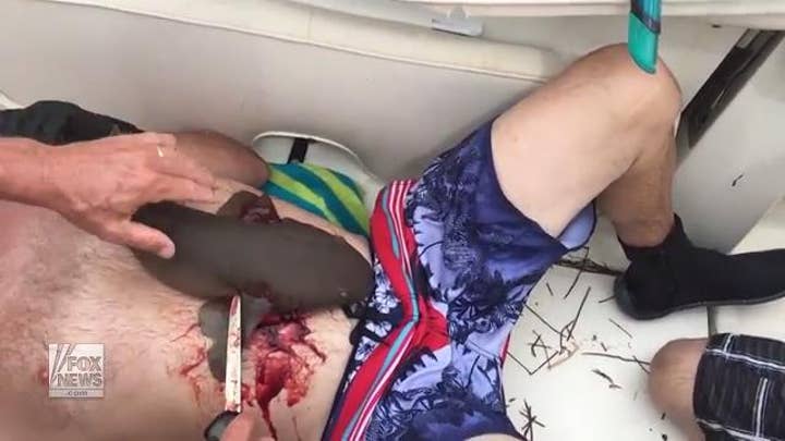 Nurse shark bites man's stomach and refuses to let go