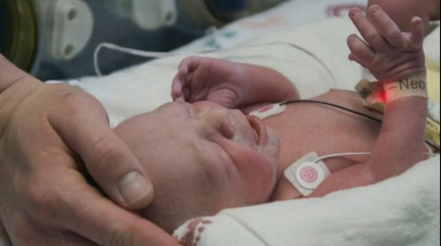 Baby born to woman who underwent uterus transplant