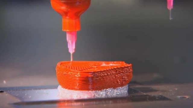 3D printed organs help doctors prep for surgery