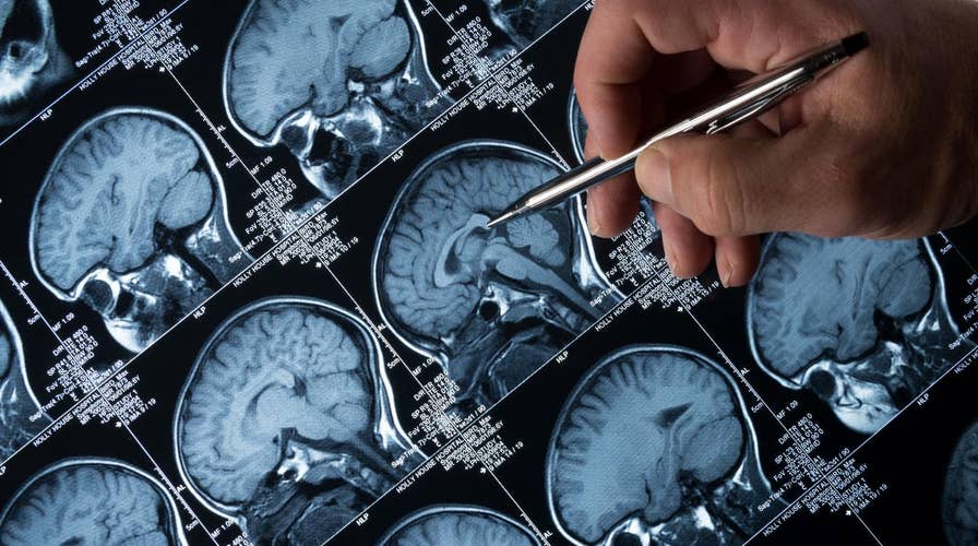 Diabetes drug may reverse Alzheimer’s symptoms