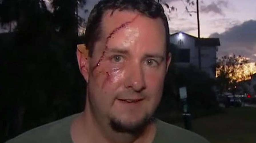 Florida man survives bear attack
