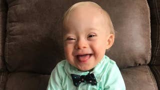 Gerber baby with Down syndrome steals hearts - Fox News