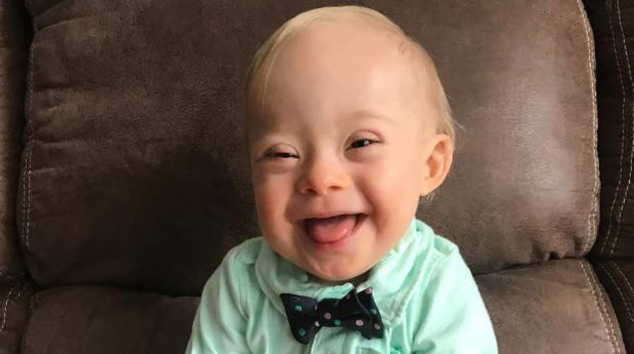 Gerber baby with Down syndrome steals hearts