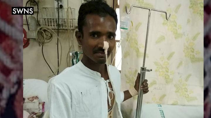 Miraculous survival after man is impaled by a 4ft pole
