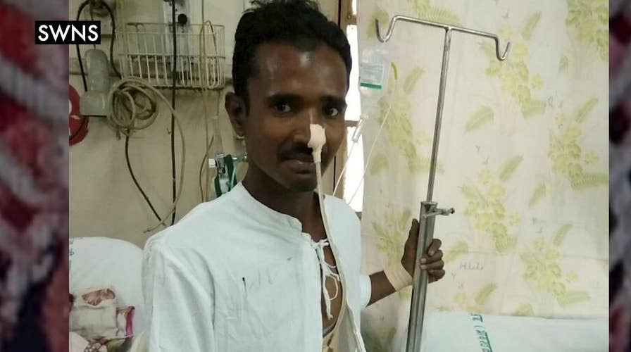 Miraculous survival after man is impaled by a 4ft pole