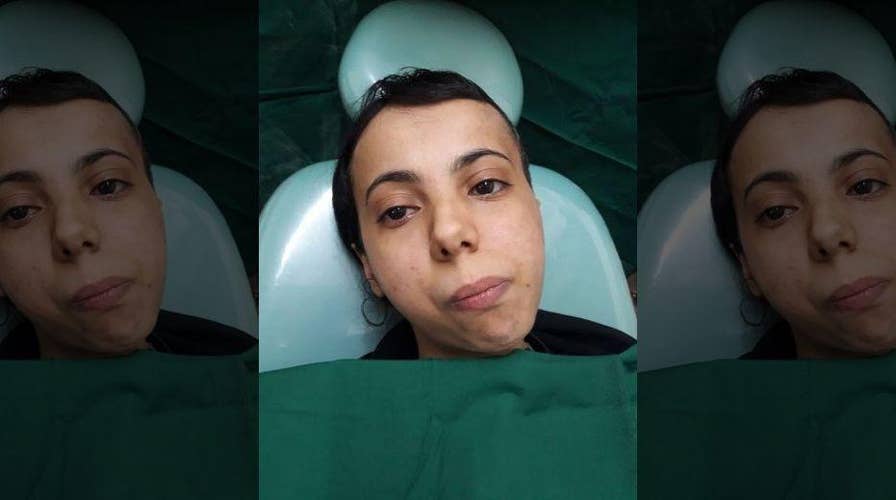 Woman who couldn't open her mouth for 30 years is finally able to chew