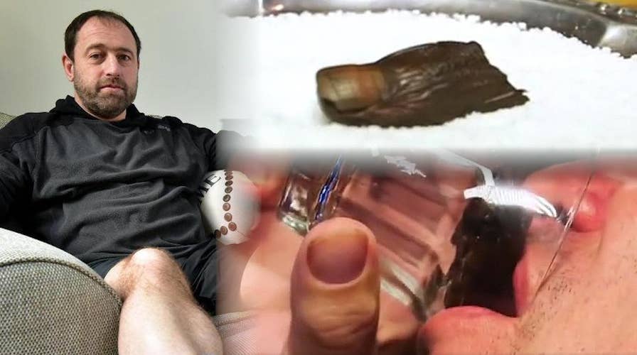 Explorer's frostbitten toes to become cocktail garnish