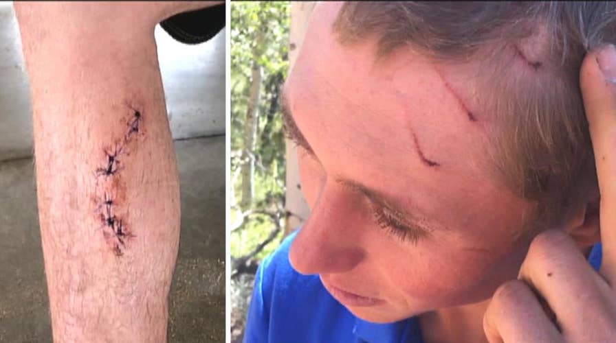 Ouch! Man bitten by shark, bear, snake in less than 4 years