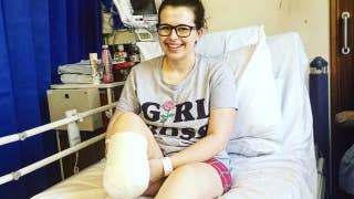 A young woman has her leg amputated after a fracture wouldn't heal - Fox News