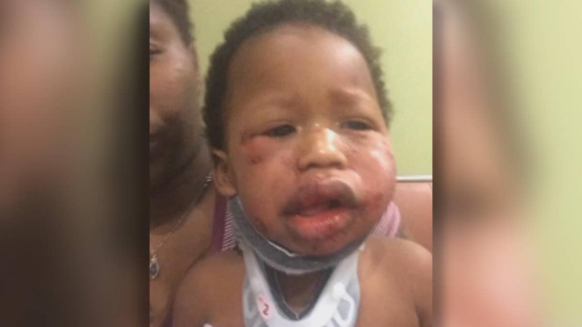 Boy beat up deals baby at daycare