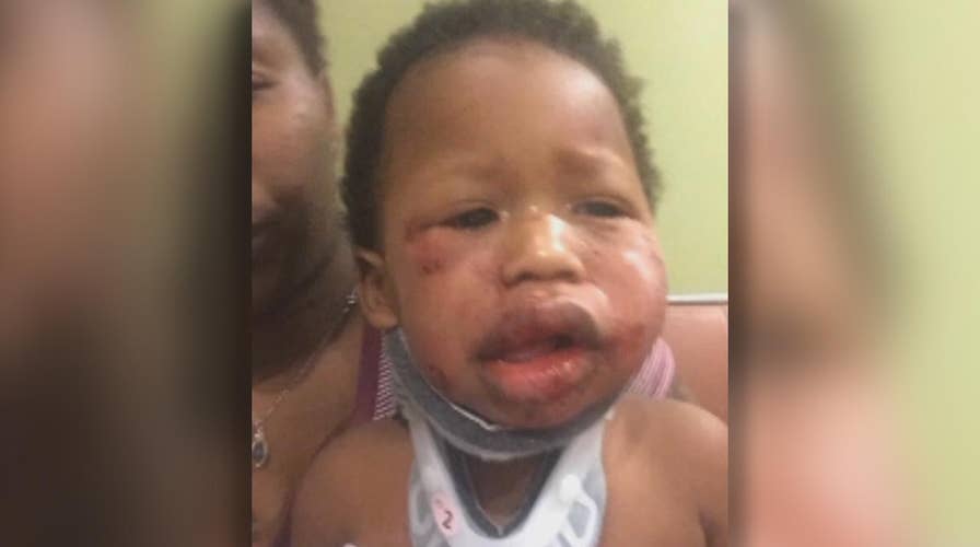 Indiana mother claims son was abused at daycare