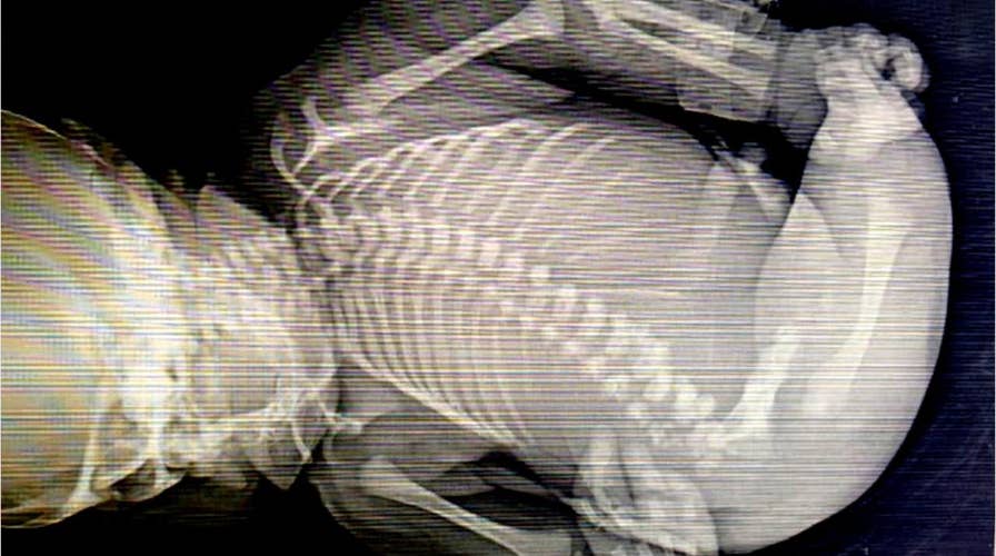 Baby with 'mermaid syndrome' dies minutes after birth