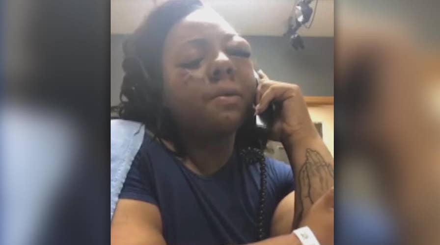 Police deny claims of beating up woman during arrest