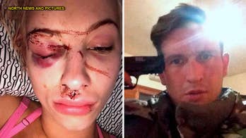 Model taken hostage by abusive boyfriend saves herself using selfie of badly beaten face