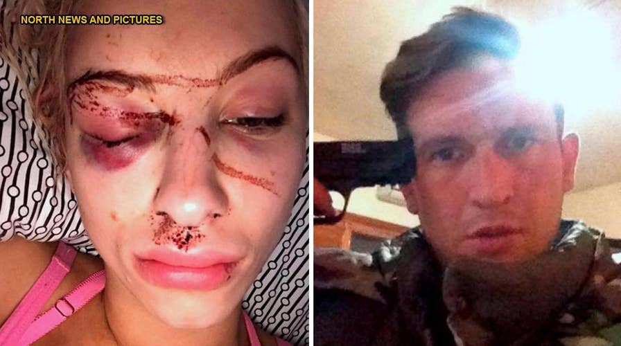 GRAPHIC PHOTO: Quick thinking model rescued by secret selfie