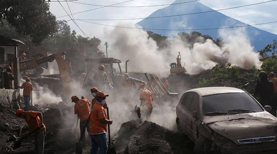 Guatemalan children with burns treated in Texas