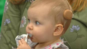 Texas parents witness 'miracle moment' toddler's face lights up as doctors turn on cochlear devices