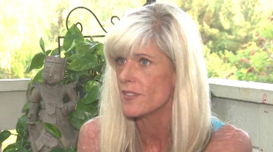 California woman denied manicure over lupus scars, she says: 'I've ...