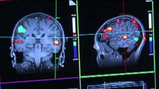 Drug shows promise in treating Alzheimer's - Fox News