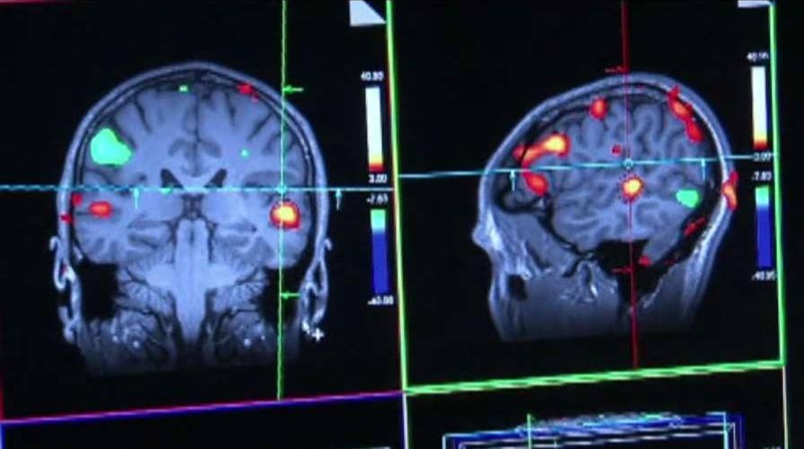 Drug shows promise in treating Alzheimer's