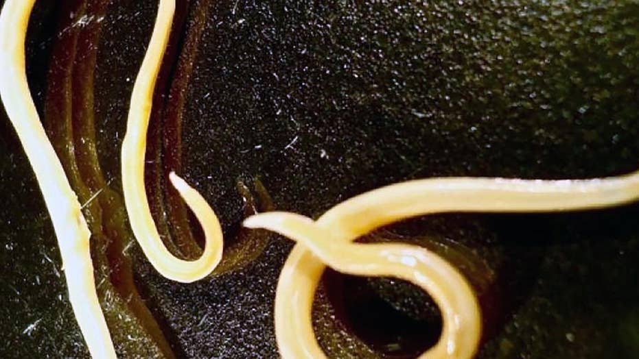 Image result for Two Prehistoric worms which became alive and began to eat after 32, 000 years and the other after 41, 700 years.