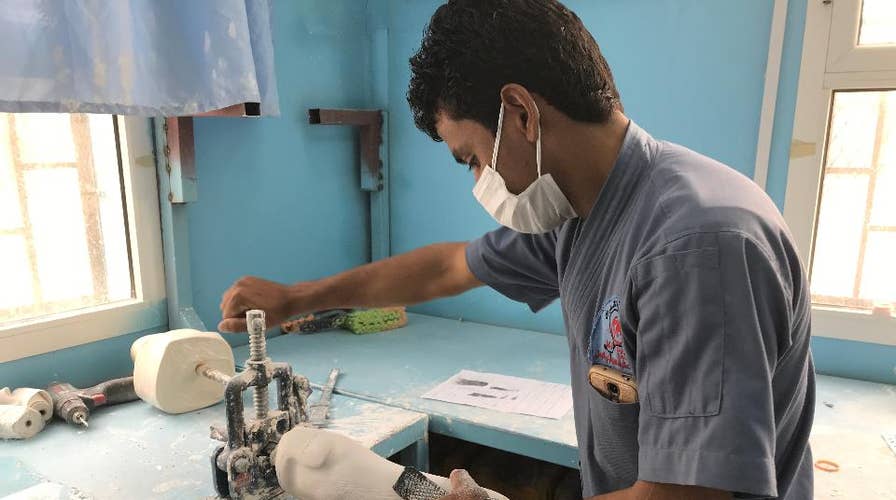 Yemen’s civil war and the prosthetic limb industry