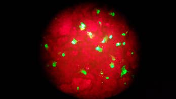 NYC reports first pediatric flu death of season