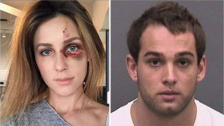 Motocross Champ S Domestic Violence Arrest Goes Viral After Accuser Posts Pictures On Instagram Fox News
