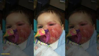 Oklahoma infant suffers second-degree burns after pulling slow cooker off counter, mom says