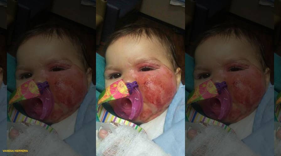 Infant suffers second-degree burns after pulling slow cooker off a counter