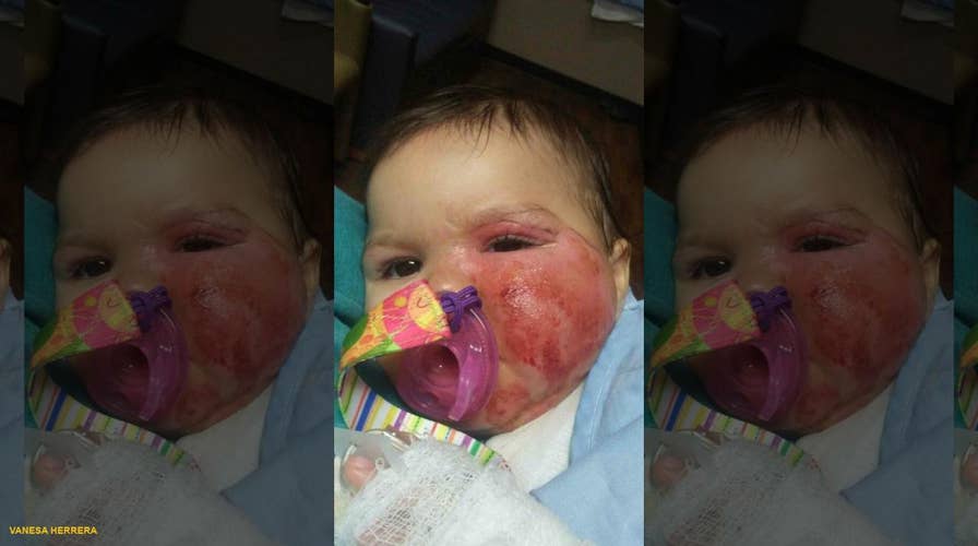 Infant suffers second-degree burns after pulling slow cooker off a counter