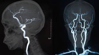 Marine biologist says brain infection wiped out memory - Fox News