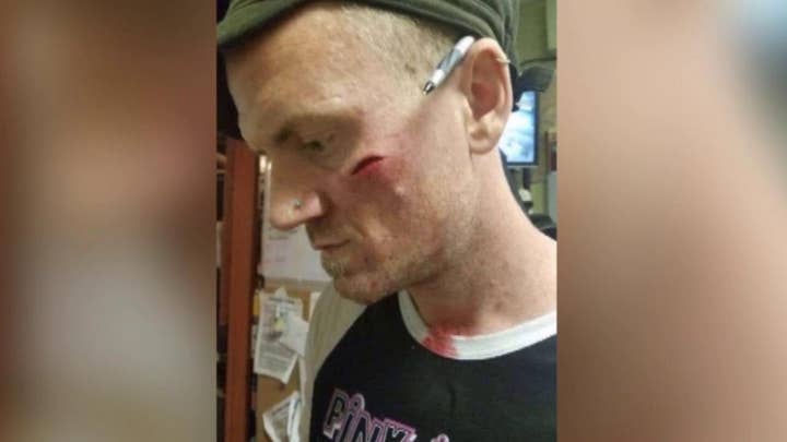 Bartender injured by glass thrown by unruly customers