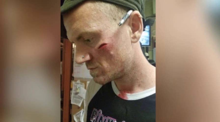 Bartender injured by glass thrown by unruly customers