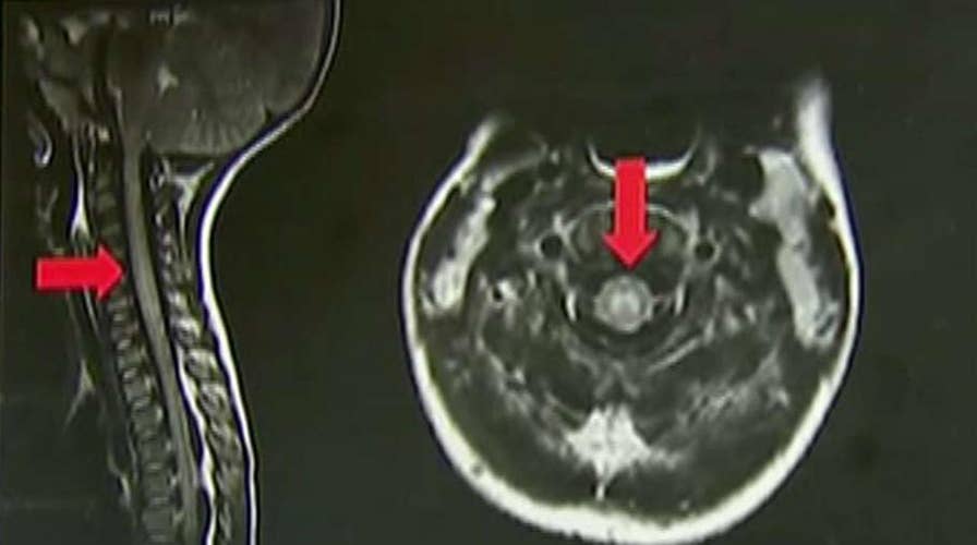 CDC tracking 'mystery illness' outbreak affecting children