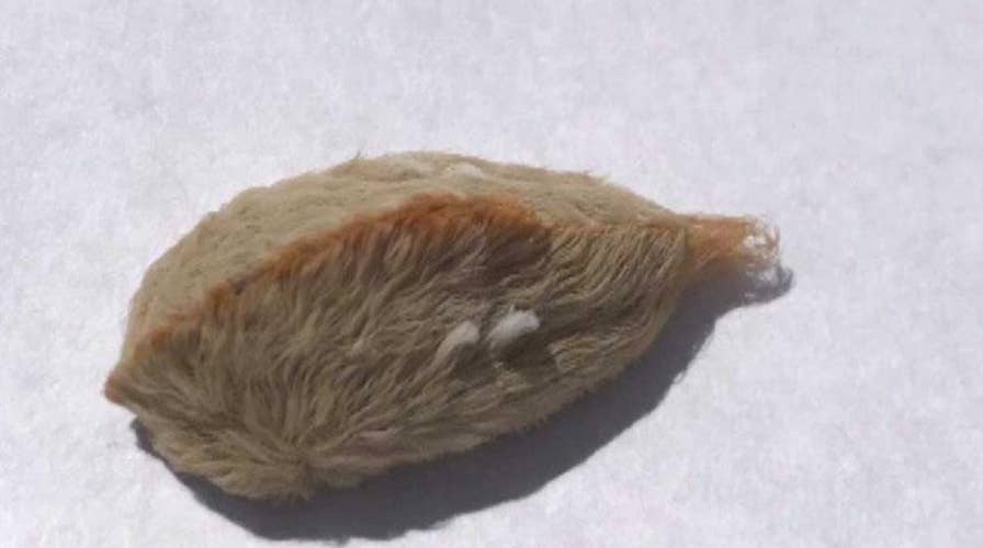 Venomous puss caterpillars have poison control on alert