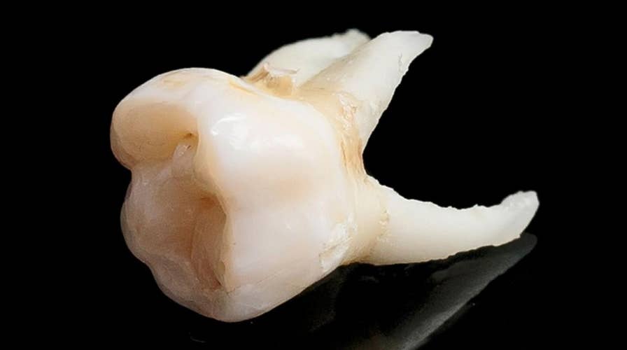 Roughly 1,000 teeth found in Georgia building’s walls