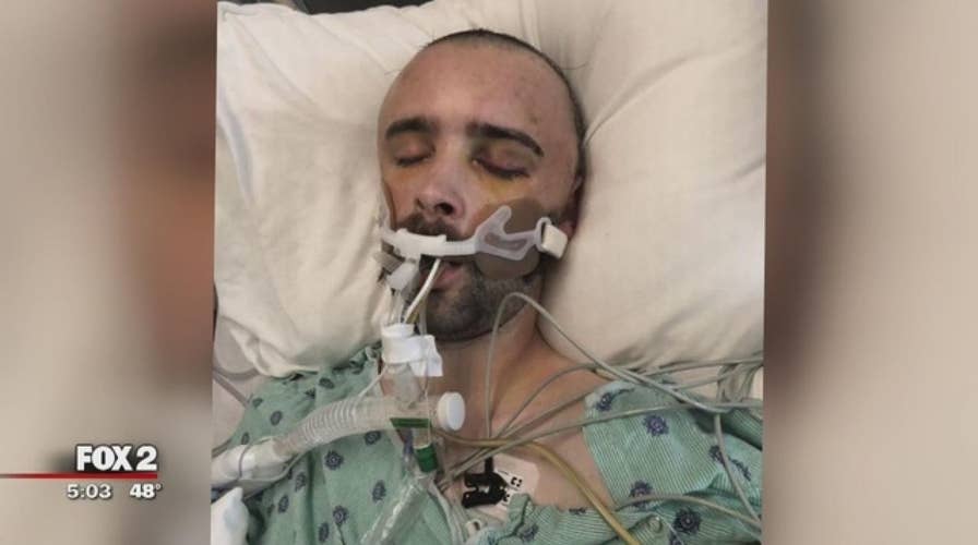 Man severely beaten while attending a bachelor party