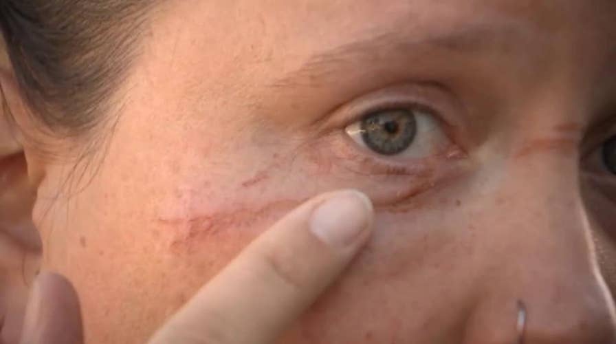 Portland cyclist injured in bike path booby trap