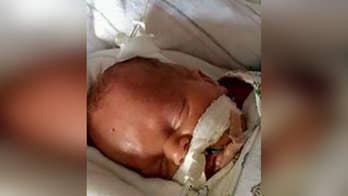 ‘Miracle baby’ survives after being given less than 1 percent chance of survival